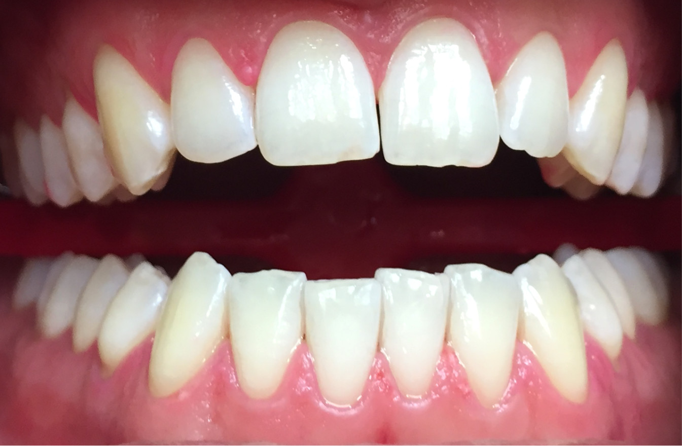 studio dentistico novara | Alessandro Miggiano